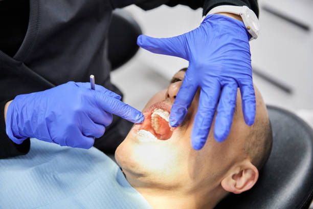Best Knocked-Out Tooth (Avulsed Tooth) Treatment in Kingsport, TN